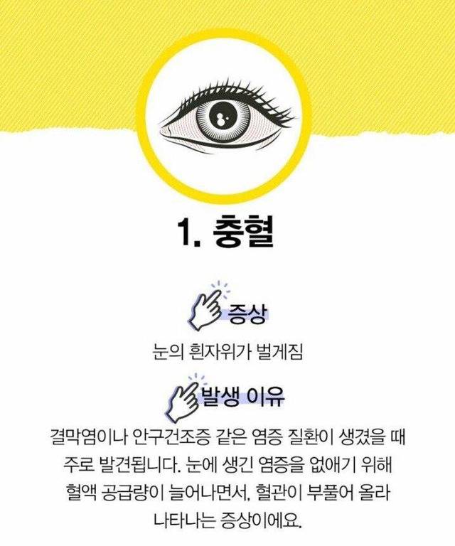 눈으로 알 수 있는 질병 | 인스티즈