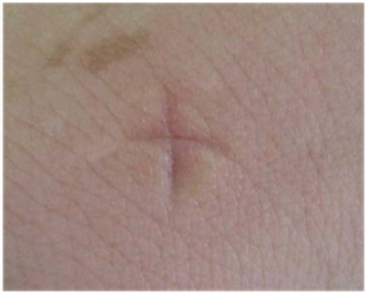 스님이 모기 물렷을때 십자가 해도된다vs안된다 | 인스티즈