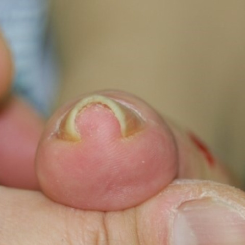 안고가야하는 내 삶의 질을 떨어뜨리는 잔병치레 모음 | 인스티즈