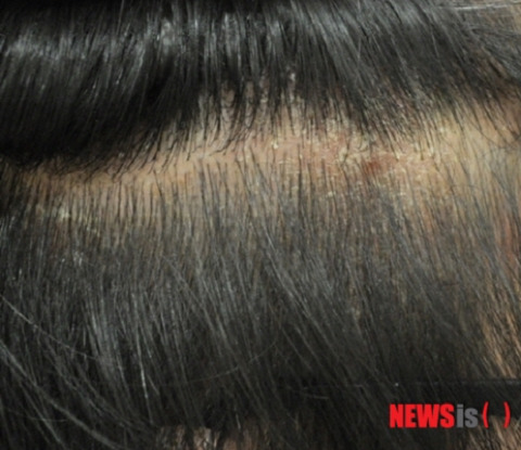 안고가야하는 내 삶의 질을 떨어뜨리는 잔병치레 모음 | 인스티즈