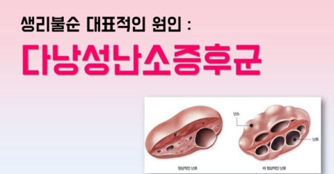 안고가야하는 내 삶의 질을 떨어뜨리는 잔병치레 모음 | 인스티즈