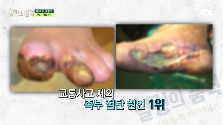 당뇨가 무서운 이유.jpg | 인스티즈