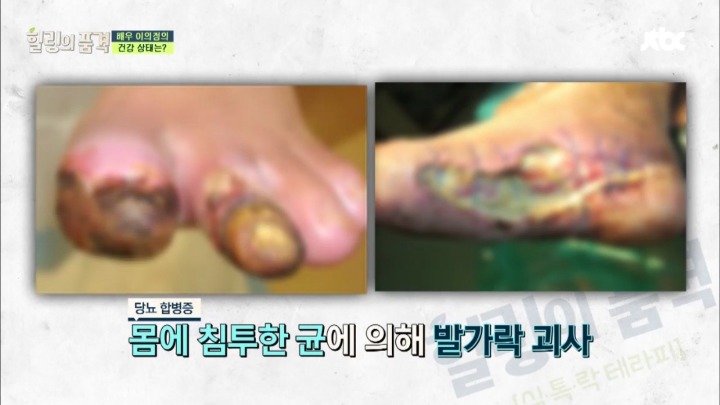 당뇨가 무서운 이유.jpg | 인스티즈