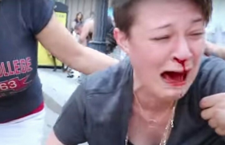 보스턴 산책 중 핏불에게 공격당하는 비글.jpgif (혐오주의) | 인스티즈