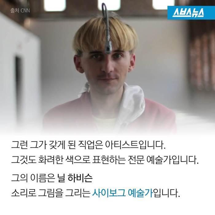  스스로 사이보그가 된 남자 | 인스티즈