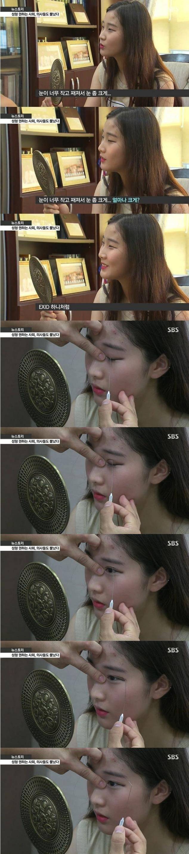 성형하는 이유 | 인스티즈