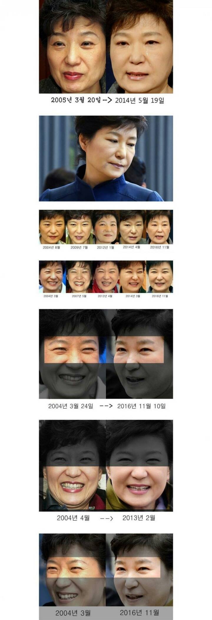 한국 현대의학은 세계최고입니다 | 인스티즈