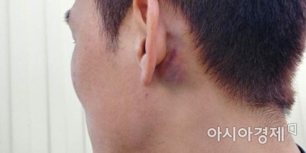 세네갈 형한테 얻어맞은 장현수ㅠㅠ | 인스티즈