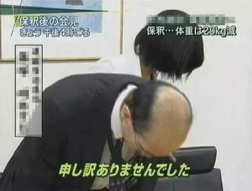 ?? : 쟤 가발 벗겨진거 아니냐 | 인스티즈