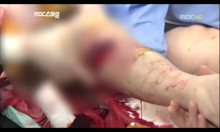 음주운전으로 피해자는 온몸이 다부서졌는데 가해자는 아무것도 없는사람(피주의) | 인스티즈