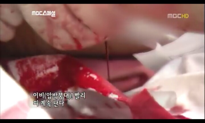 음주운전으로 피해자는 온몸이 다부서졌는데 가해자는 아무것도 없는사람(피주의) | 인스티즈