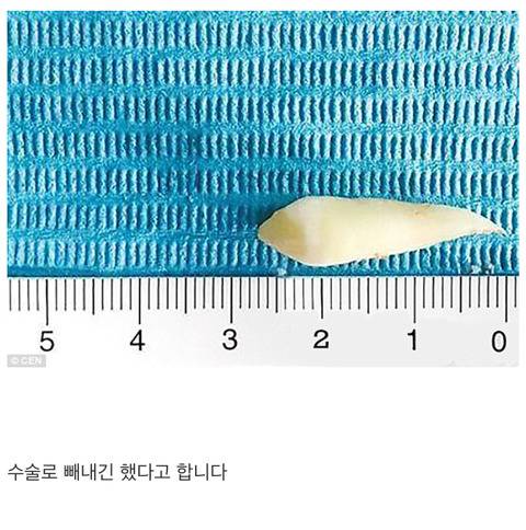 환자랑 의사랑 서로 대화가 안통함.jpg | 인스티즈