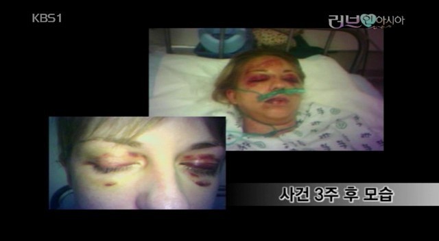 성폭행 미수 피해 외국여성이 한국에서 당한 모욕 | 인스티즈