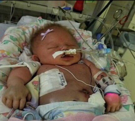 아기에게 함부로 뽀뽀하면 안되는 이유 | 인스티즈