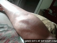 아픈데 은근히 즐기는 사람 많은 이것.gif | 인스티즈