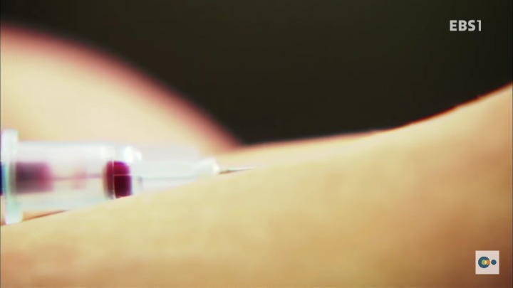 아픔을 느낄 수 없다면 좋은걸까? 무통증 환자 삼남매 이야기. #2 | 인스티즈