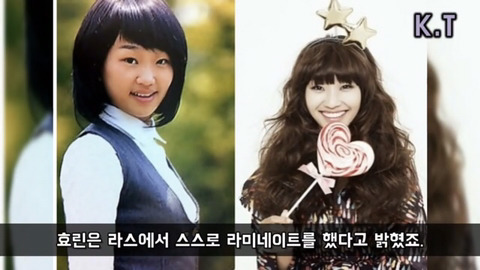 연예인들 라미네이트 전후 | 인스티즈