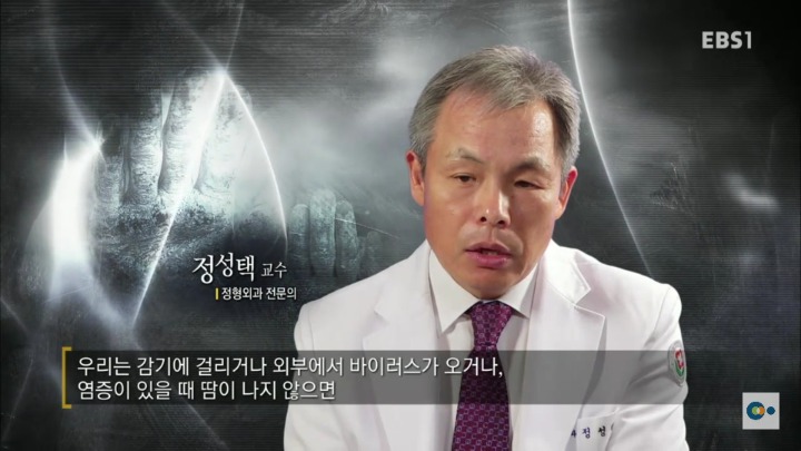 아픔을 느낄 수 없다면 좋은걸까? 무통증 환자 삼남매 이야기. #2 | 인스티즈