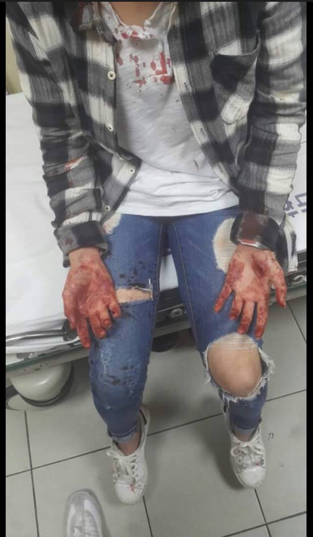 [피사진주의] 전 남친이랑 말 좀 했다고 여친 폭행 | 인스티즈