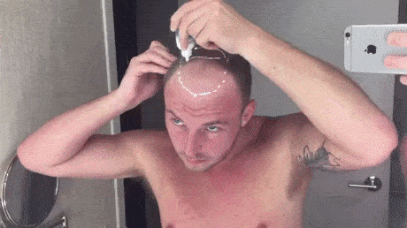 탈모인의 변신.JPG | 인스티즈