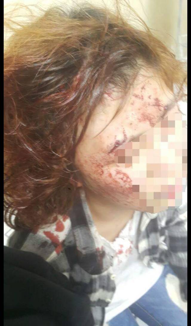 [피사진주의] 전 남친이랑 말 좀 했다고 여친 폭행 | 인스티즈