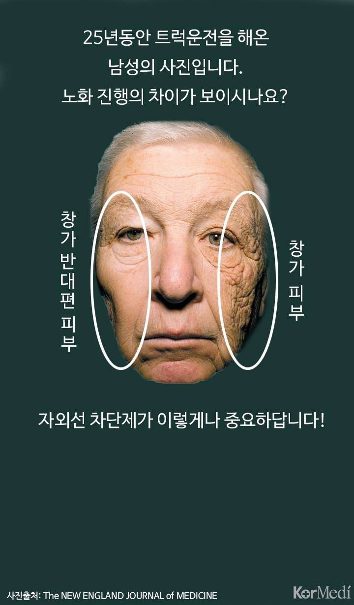 썬크림을 발라야하는 이유.jpg | 인스티즈