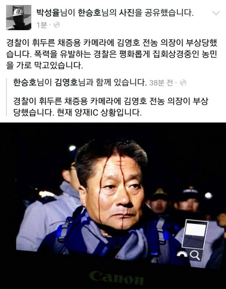 경찰이 휘두른 채증용 카메라에 부상 당한 농민(피 주의) | 인스티즈