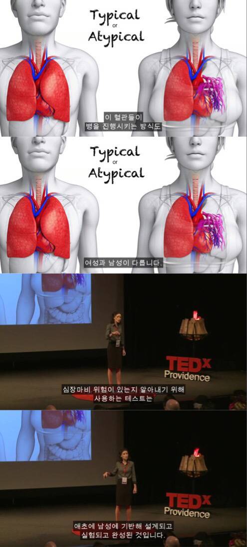 왜 약은 종종 여성에게 위험한 부작용이 있는가 | 인스티즈