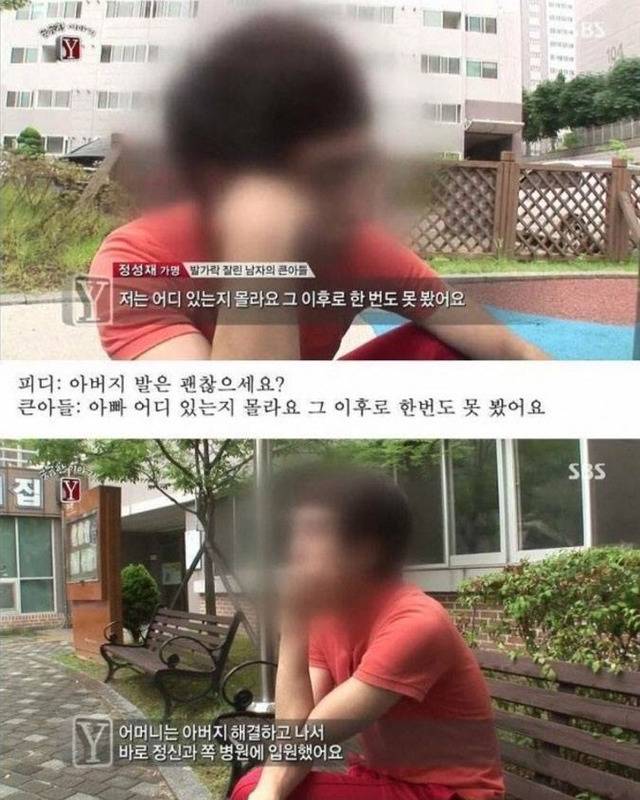 자고 일어나니 발가락이 모두 사라진 남자 | 인스티즈