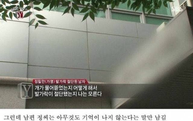 자고 일어나니 발가락이 모두 사라진 남자 | 인스티즈