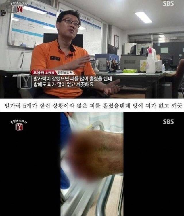 자고 일어나니 발가락이 모두 사라진 남자 | 인스티즈