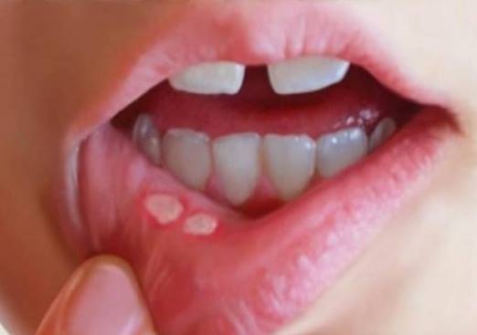 이 고통 아는사람 손 | 인스티즈