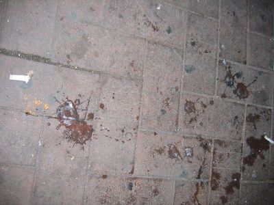 [사진주의] 길거리 짜증나는 민폐유형중 하나 | 인스티즈