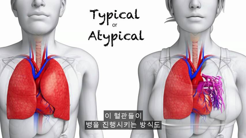 [TED] 왜 약은 종종 여성에게 위험한 부작용이 있는가 | 인스티즈