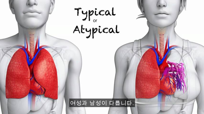 [TED] 왜 약은 종종 여성에게 위험한 부작용이 있는가 | 인스티즈