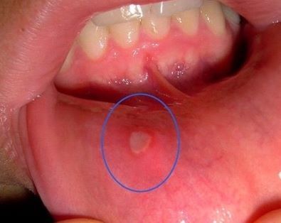 이 고통 아는사람 손 | 인스티즈