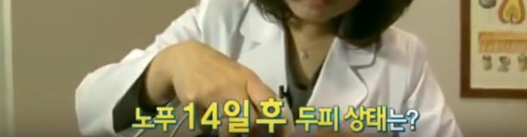 1년간 샴푸를 끊으면 생기는 머리의 변화 | 인스티즈