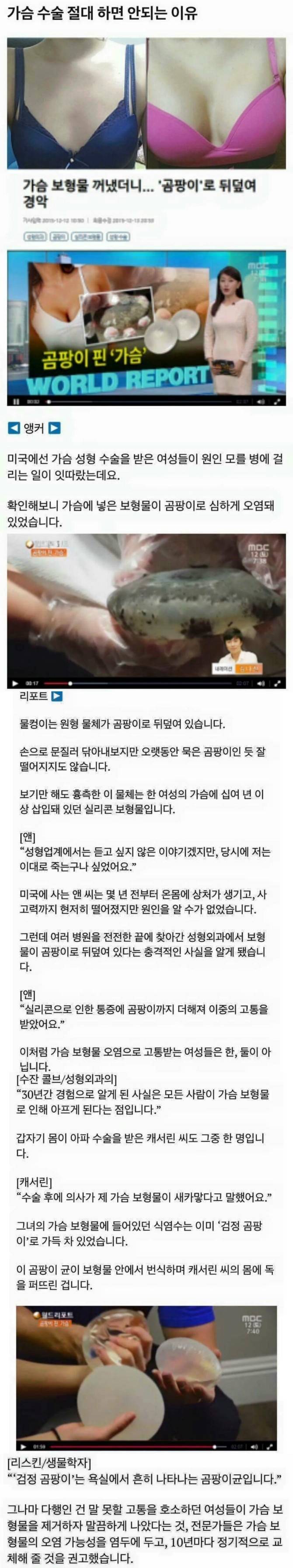 가슴보형물 수술 절대 하면 안되는 이유.... | 인스티즈