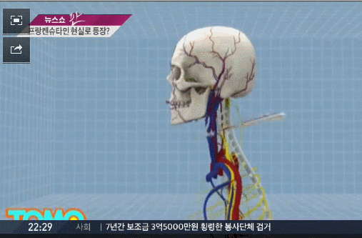 드디어 시도하는 머리이식 수술 ㄷㄷ | 인스티즈