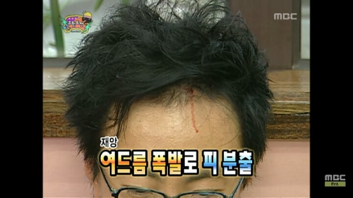 [무한도전] 받아쓰기 하다 이마에서 여드름터져 줄줄 흐르는 명수옹 | 인스티즈