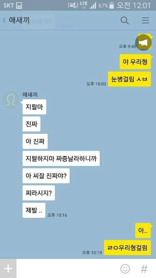 ???: 야 우리형 눈병 걸림 ㅅㅂ | 인스티즈