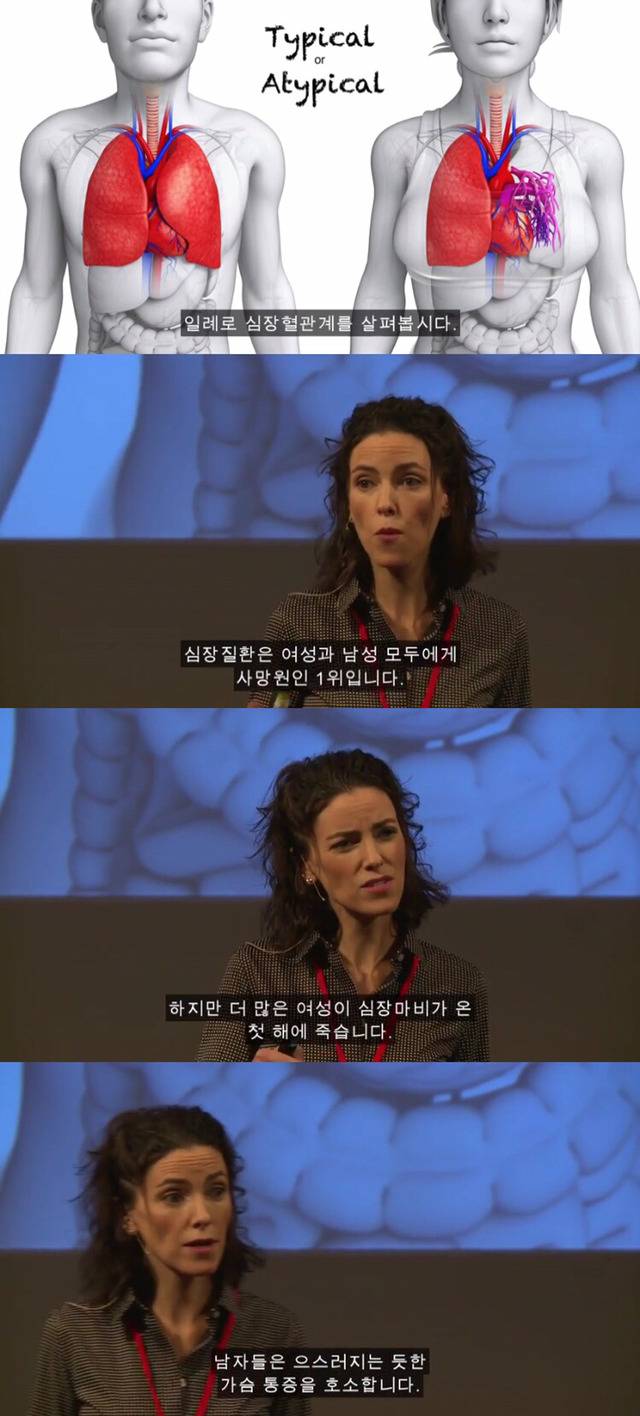 왜 약은 종종 여성에게 위험한 부작용이 있는가 | 인스티즈