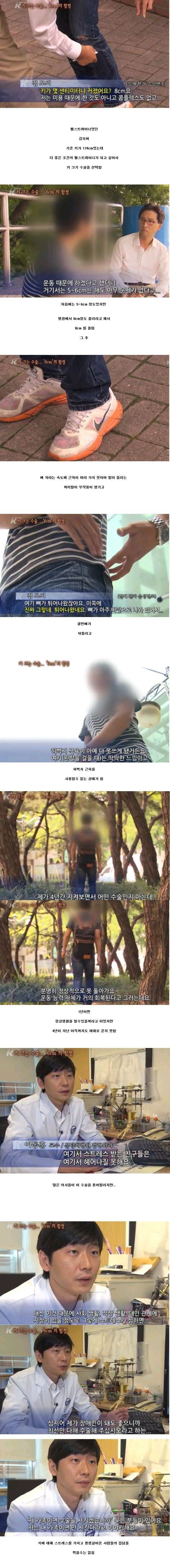 키 크는 수술 | 인스티즈