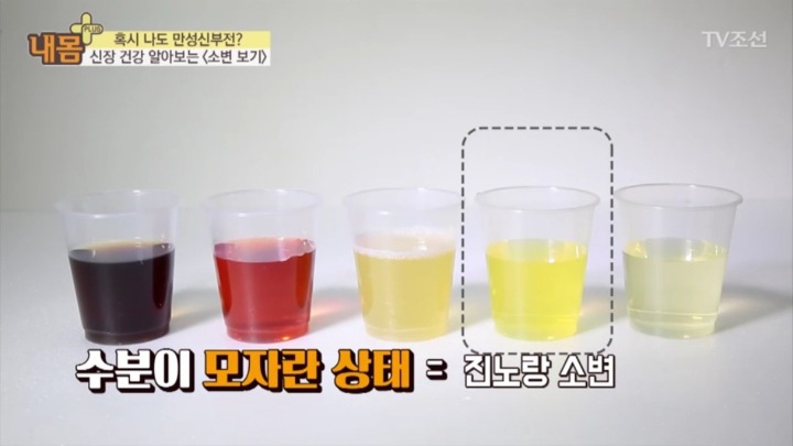 소변 색으로 보는 신장 건강 | 인스티즈