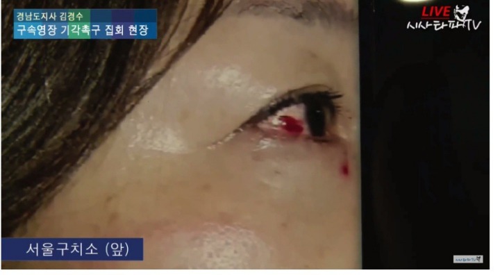 미방) 서울구치소에서 박사모가 김경수 지지자 눈을 찌름 | 인스티즈