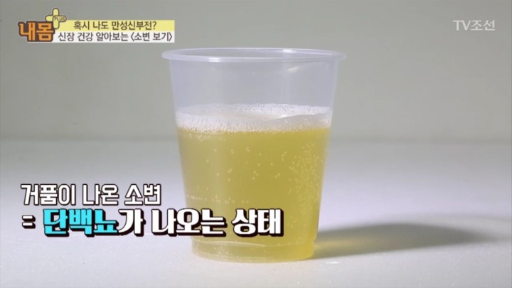 소변 색으로 보는 신장 건강 | 인스티즈