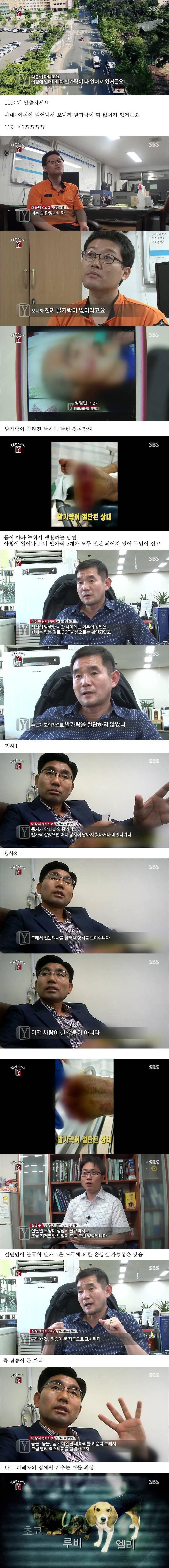 자고 일어났더니 사라진 발가락 (혐오주의) | 인스티즈