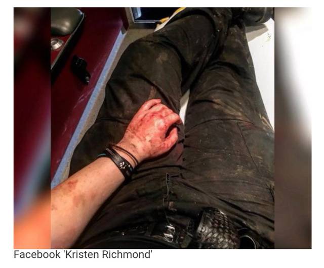 범인에게 폭행당해 피투성이가 됐음에도 끝까지 버틴 미국 여경 클래스(사진주의).jpg | 인스티즈