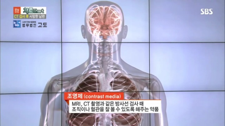 CT사진 찍다가 사망한 남편 | 인스티즈
