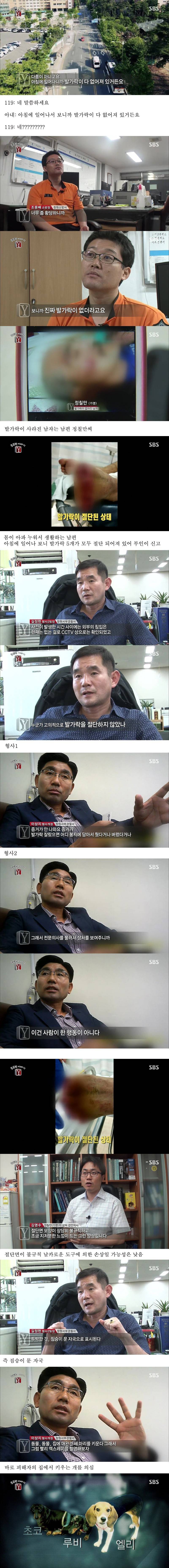 자고 일어났더니 사라진 발가락 (혐오주의) | 인스티즈